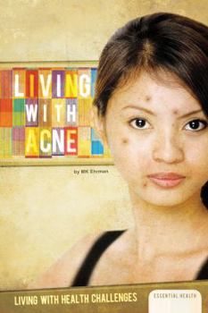 Living with Acne - Book  of the Living with Health Challenges