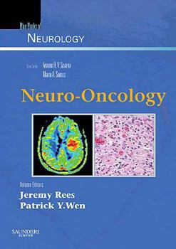 Hardcover Neuro-Oncology: Blue Books of Neurology Series Volume 36 Book