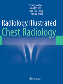 Paperback Radiology Illustrated: Chest Radiology Book