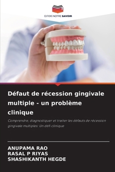 Paperback Défaut de récession gingivale multiple - un problème clinique [French] Book