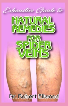Exhaustive Guide To Natural Remedies for Spider Veins: A Simple guide to all there is to know about spider veins, its conventional treatments as well as its natural remedy! Discover the truth!