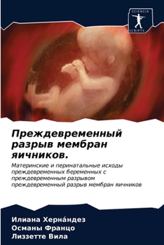 Paperback Преждевременный разрыв & [Russian] Book