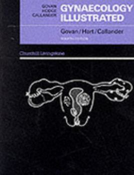 Paperback Gynaecology Illustrated 4/E Book