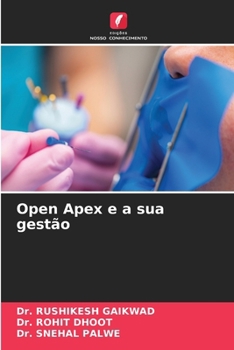 Paperback Open Apex e a sua gestão [Portuguese] Book