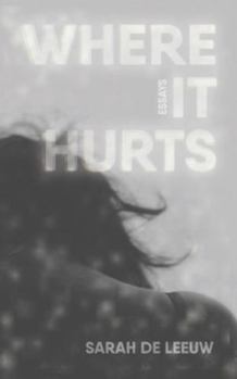 Paperback Where It Hurts Book