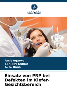 Paperback Einsatz von PRP bei Defekten im Kiefer-Gesichtsbereich [German] Book