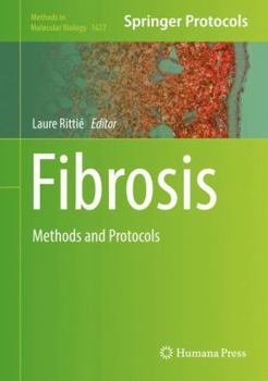 Fibrosis: Methods and Protocols - Book #1627 of the Methods in Molecular Biology