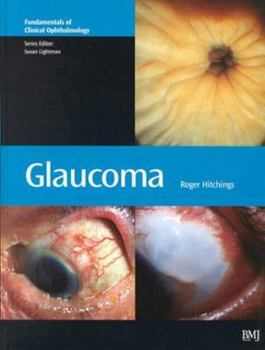 Hardcover Glaucoma Book