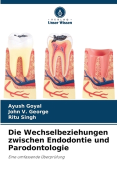 Paperback Die Wechselbeziehungen zwischen Endodontie und Parodontologie [German] Book