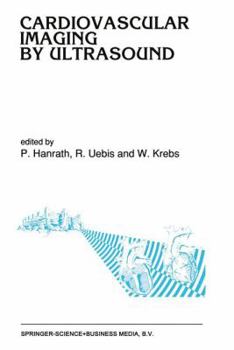 Paperback Cardiovascular Imaging by Ultrasound Book