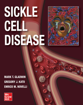 Hardcover Sickle Cell Disease Book