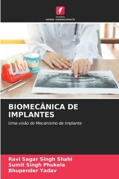 Paperback Biomecânica de Implantes [Portuguese] Book