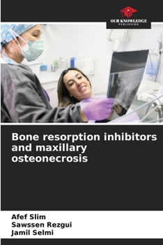 Paperback Bone resorption inhibitors and maxillary osteonecrosis Book