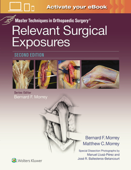 Hardcover Master Techniques in Orthopaedic Surgery: Relevant Surgical Exposures Book