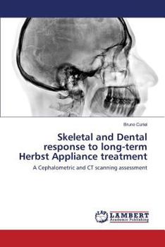 Paperback Skeletal and Dental response to long-term Herbst Appliance treatment Book
