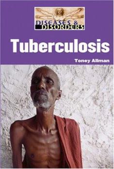 Library Binding Tuberculosis Book