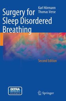 Paperback Surgery for Sleep Disordered Breathing Book