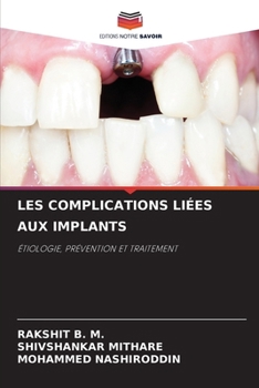 Paperback Les Complications Liées Aux Implants [French] Book