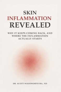 Paperback Skin Inflammation Revealed: Why It Keeps Coming Back, And Where The Inflammation Actually Starts Book