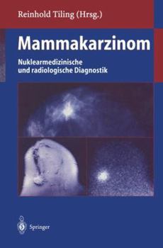 Paperback Mammakarzinom: Nuklearmedizinische Und Radiologische Diagnostik [German] Book