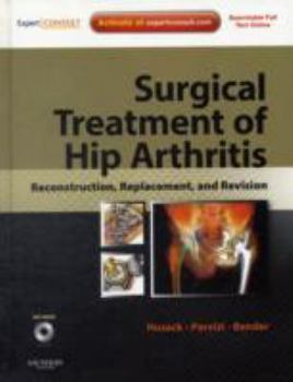 Paperback Surgical Treatment of Hip Arthritis: Reconstruction, Replacement, and Revision: Expert Consult - Online and Print with DVD Book