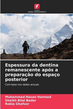 Paperback Espessura da dentina remanescente após a preparação do espaço posterior [Portuguese] Book