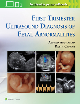 Hardcover First Trimester Ultrasound Diagnosis of Fetal Abnormalities Book