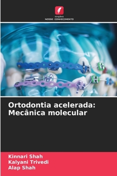 Paperback Ortodontia acelerada: Mecânica molecular [Portuguese] Book