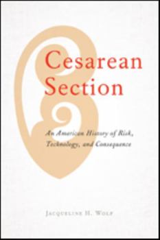Cesarean Section: An American History of Risk, Technology, and Consequence