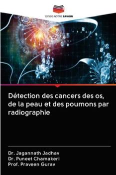 Paperback Détection des cancers des os, de la peau et des poumons par radiographie [French] Book
