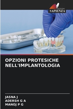 Opzioni Protesiche Nell'implantologia (Italian Edition)