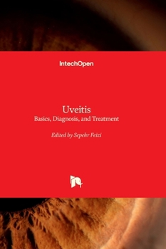 Hardcover Uveitis - Basics, Diagnosis, and Treatment Book
