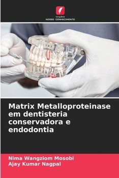 Paperback Matrix Metalloproteinase em dentisteria conservadora e endodontia [Portuguese] Book