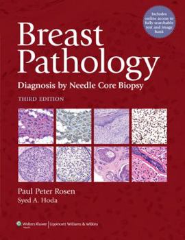 Hardcover Breast Pathology: Diagnosis by Needle Core Biopsy Book