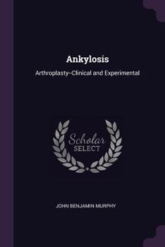 Paperback Ankylosis: Arthroplasty--Clinical and Experimental Book