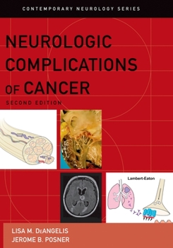 Hardcover Neurologic Complications of Cancer Book