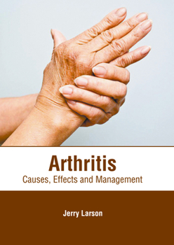 Hardcover Arthritis: Causes, Effects and Management Book