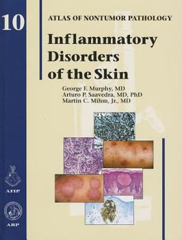 Hardcover Inflammatory Disorders of the Skin Book