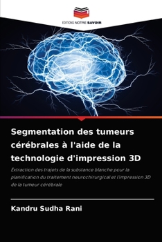 Paperback Segmentation des tumeurs cérébrales à l'aide de la technologie d'impression 3D [French] Book
