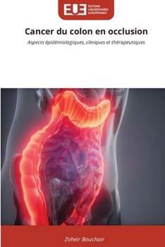 Paperback Cancer du colon en occlusion [French] Book