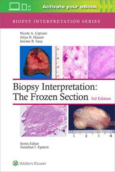 Hardcover Biopsy Interpretation: The Frozen Section: Print + eBook with Multimedia Book