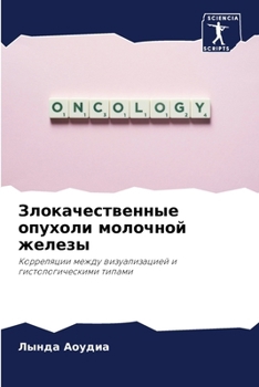 Paperback Злокачественные опухол&# [Russian] Book