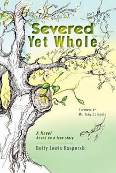 Severed Yet Whole: A Novel Based on a True Story