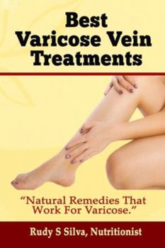 Paperback Best Varicose Vein Treatments: Natural Remedies That Work for Varicose [Large Print] Book