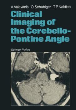 Paperback Clinical Imaging of the Cerebello-Pontine Angle Book