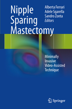Hardcover Nipple Sparing Mastectomy: Minimally Invasive Video-Assisted Technique Book