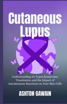 Cutaneous Lupus: Understanding Its Types, Symptoms, Treatments, and the Impact of Autoimmune Reactions on Your Skin Cells
