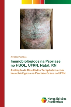 Paperback Imunobiológicos na Psoríase no HUOL, UFRN, Natal, RN [Portuguese] Book