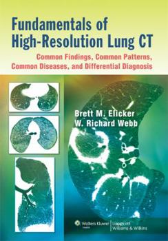 Paperback Fundamentals of High-Resolution Lung Ct: Common Findings, Common Patterns, Common Diseases, and Differential Diagnosis: Common Findings, Common Patter Book