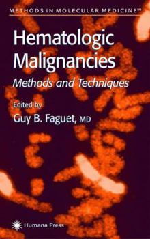 Paperback Hematologic Malignancies: Methods and Techniques Book